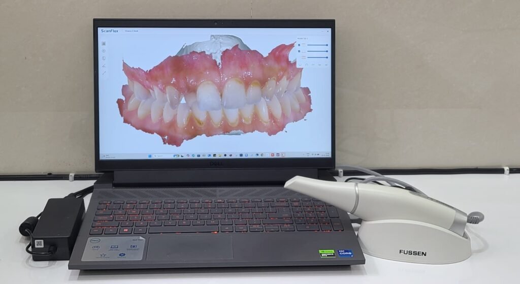 Vita-Dentistry-Bagalkot-Inter-Oral-Scanner-
