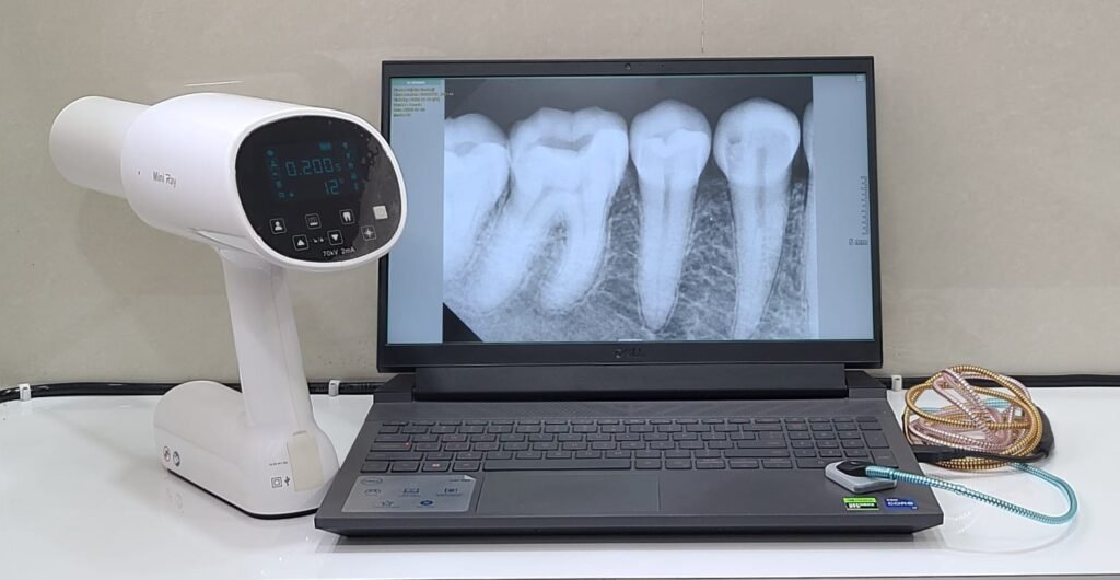 Vita-Dentistry-Bagalkot-RVG-Digital-Xray